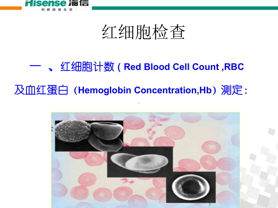 医学血常规检查及其意义医生解读培训课件.ppt_第3页