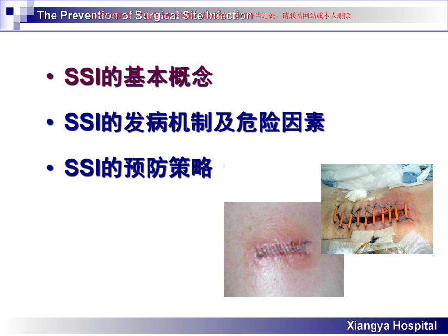 外科部位感染的分析和预防课件.ppt_第1页