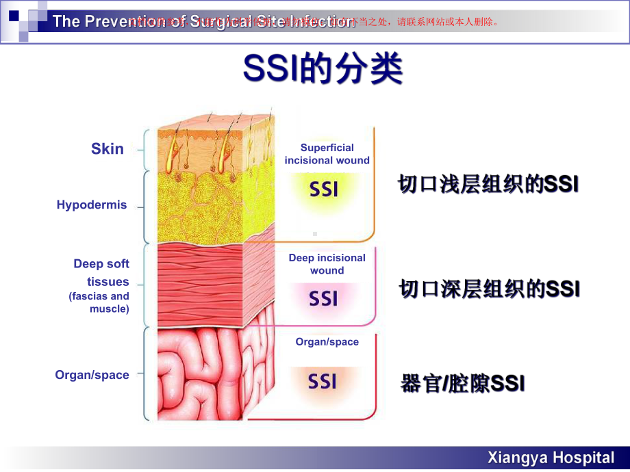 外科部位感染的分析和预防课件.ppt_第3页