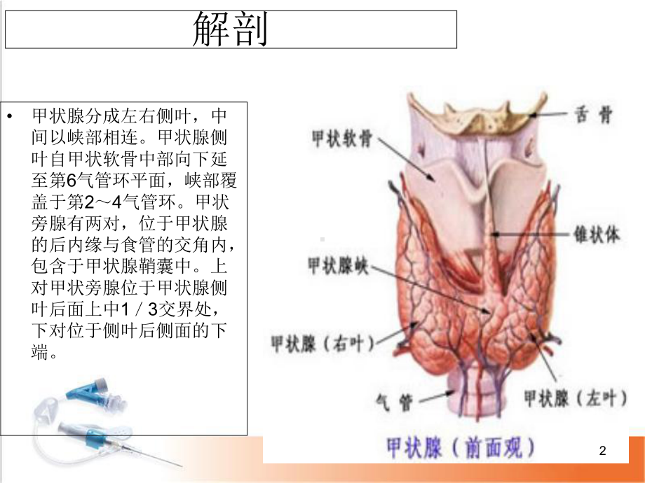 医学课件-常见甲状腺疾病的CT诊断课件.ppt_第2页