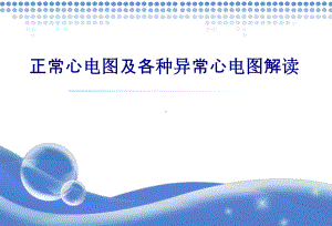 医学正常心电图及各种异常心电图解读专题培训课件.ppt