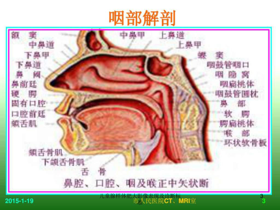 儿童腺样体肥大影像表现及诊断标准课件.ppt_第3页