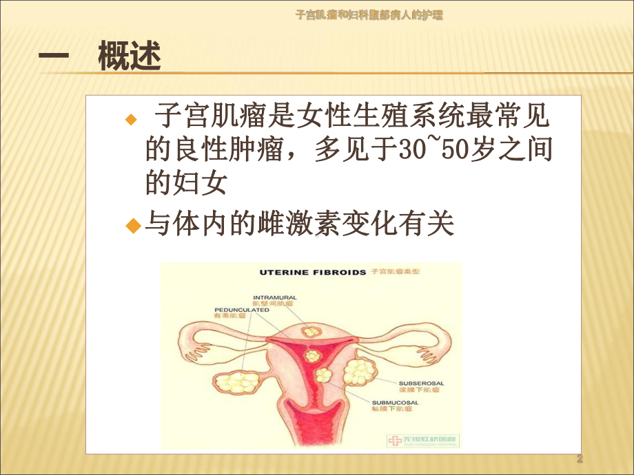 子宫肌瘤和妇科腹部病人的护理培训课件.ppt_第2页