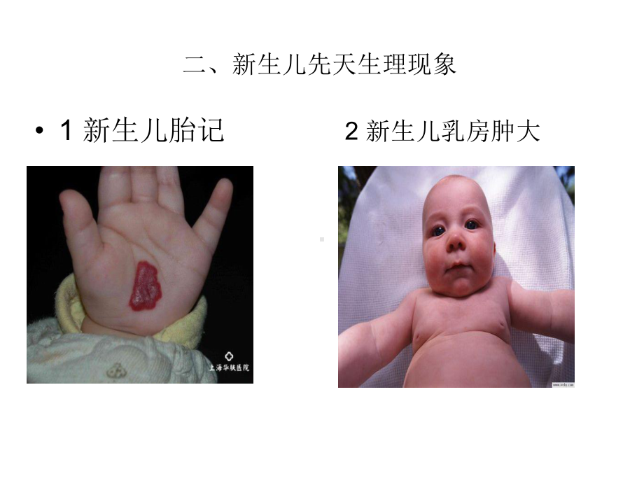 婴幼儿常见生理现象和黄疸讲述课件.ppt_第3页