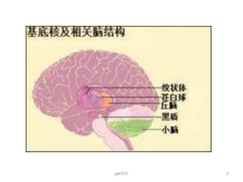 基底节区解剖位置关系图及临床-课件.ppt_第3页