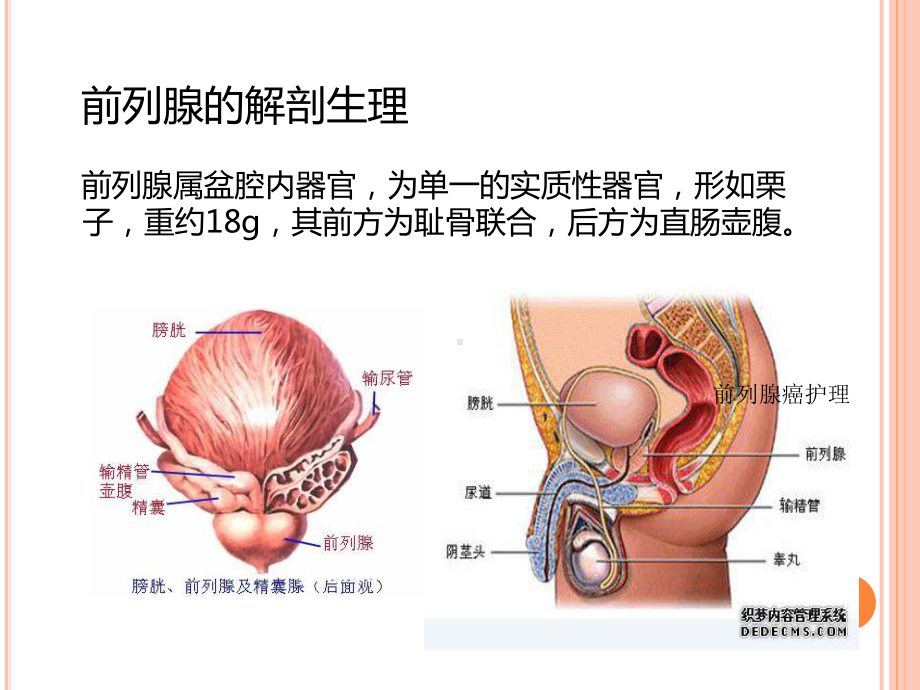 前列腺癌护理培训课件.ppt_第3页