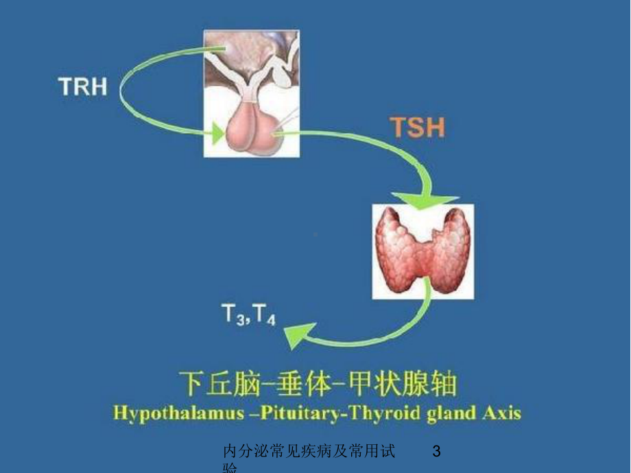 内分泌常见疾病及常用试验培训课件.ppt_第3页