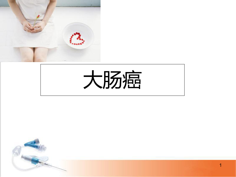 医学课件-大肠癌课件.ppt_第1页