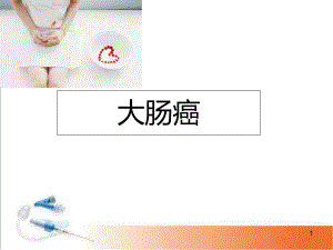 医学课件-大肠癌课件.ppt