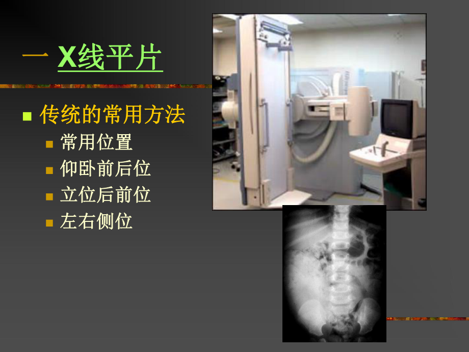 医学肝脏培训课件.ppt_第3页