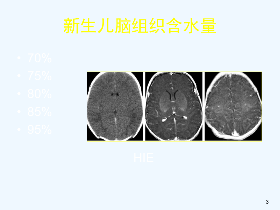 儿童神经影像诊断课件.ppt_第3页