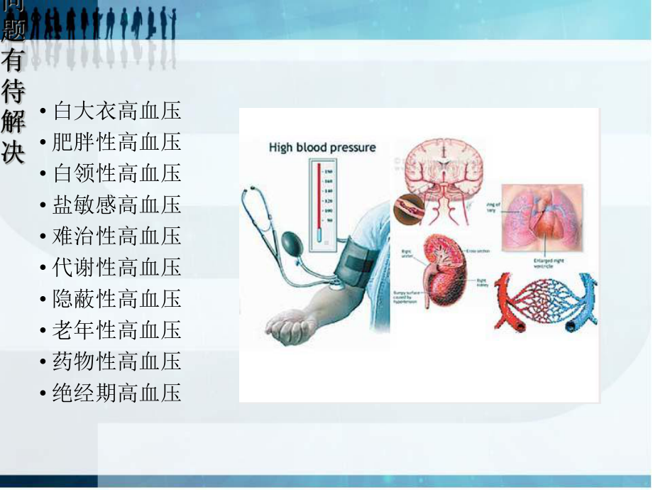 低舒张压收缩期高血压的临床特点及处理课件.ppt_第3页