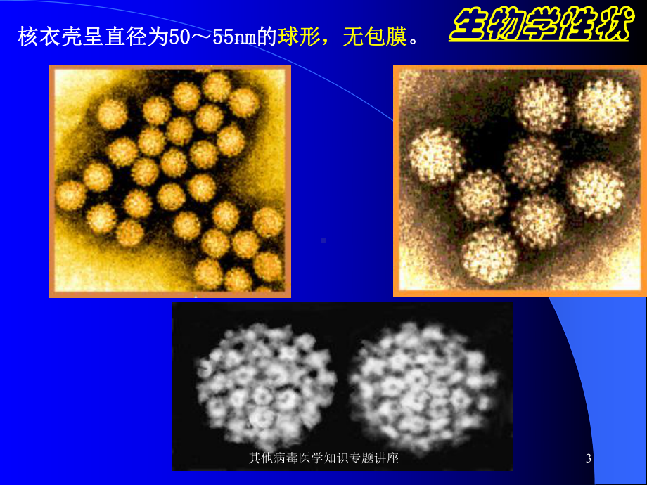 其他病毒医学知识专题讲座培训课件.ppt_第3页