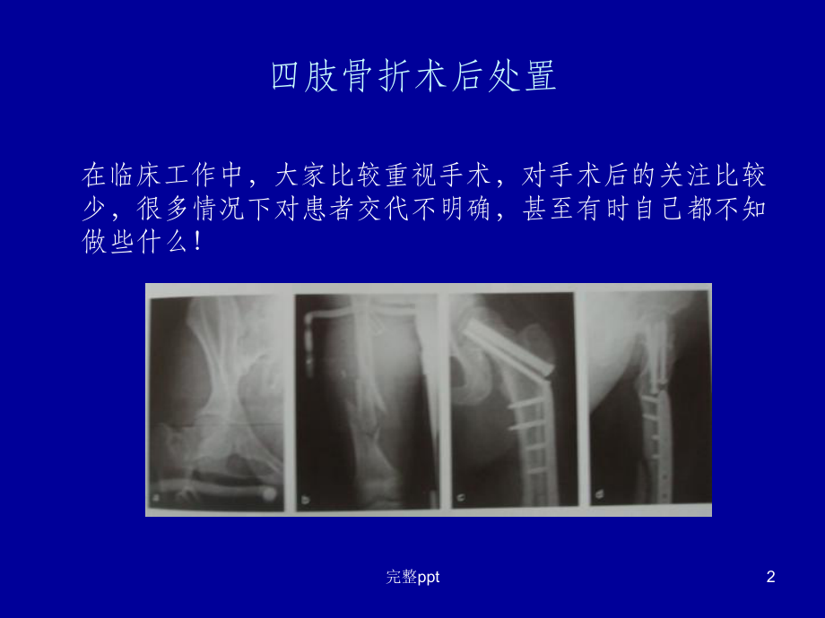 四肢骨折术后处置课件.ppt_第2页