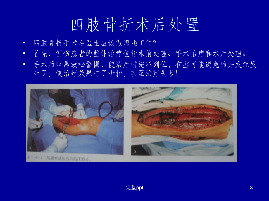 四肢骨折术后处置课件.ppt_第3页