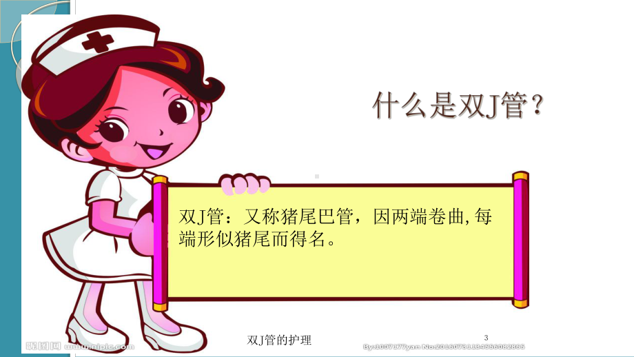 双J管的护理培训课件.ppt_第3页