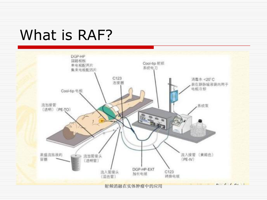 射频消融在实体肿瘤中的应用课件.ppt_第2页