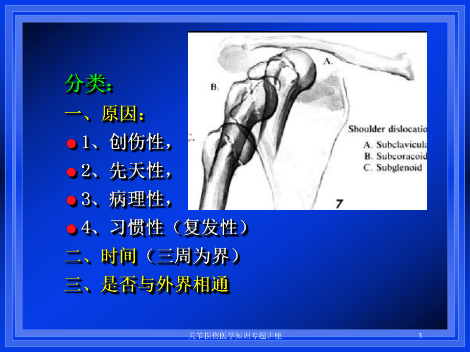 关节损伤医学知识专题讲座培训课件.ppt_第3页