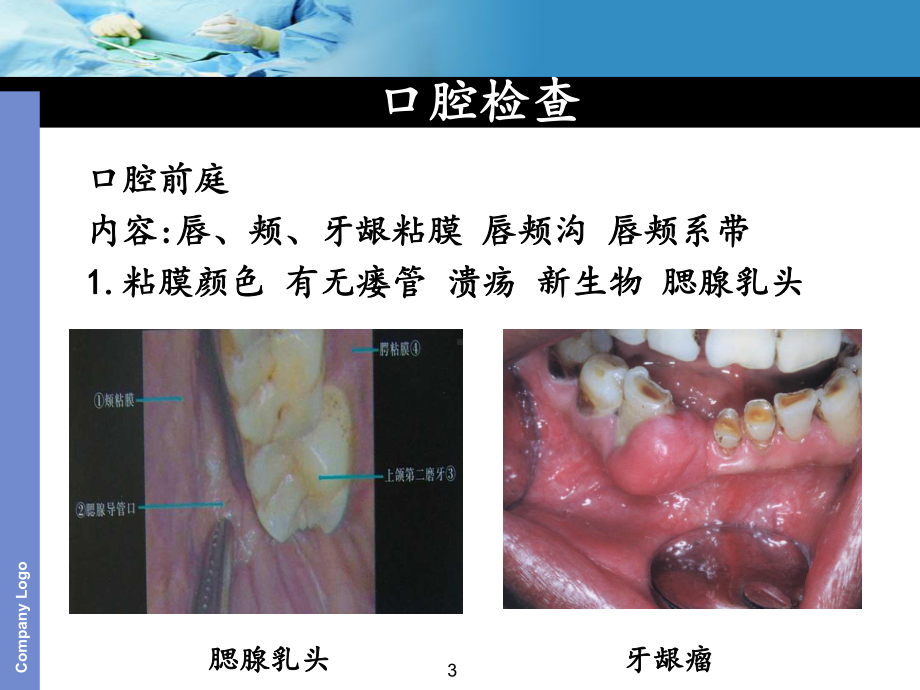 口腔颌面外科临床检查课件.pptx_第3页