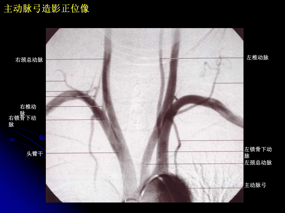 医学神经血管解剖图培训课件.ppt_第2页