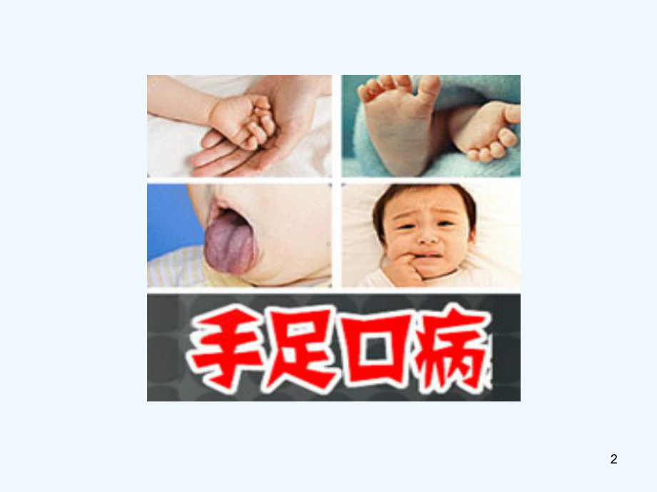 小儿手足口病临床特点与防治课件.ppt_第2页