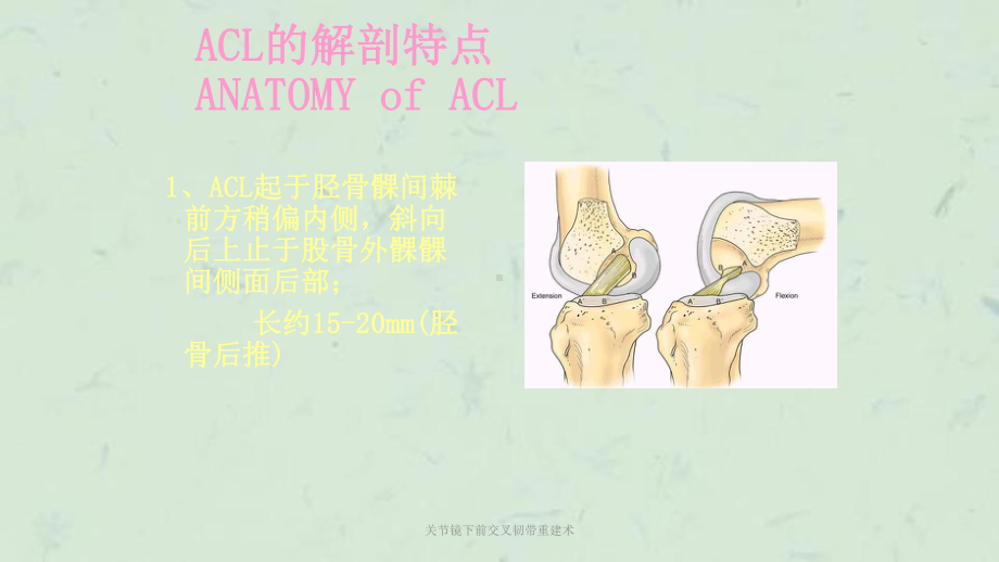 关节镜下前交叉韧带重建术课件.ppt_第2页
