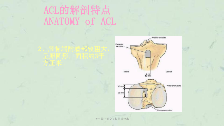 关节镜下前交叉韧带重建术课件.ppt_第3页