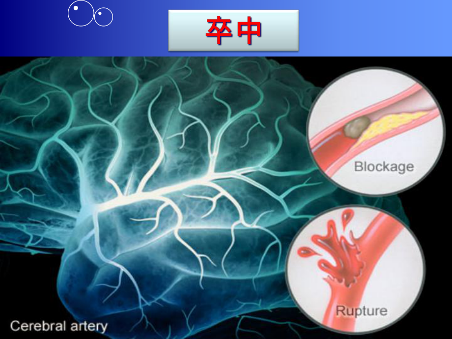 卒中内科用药干预规范课件.ppt_第3页