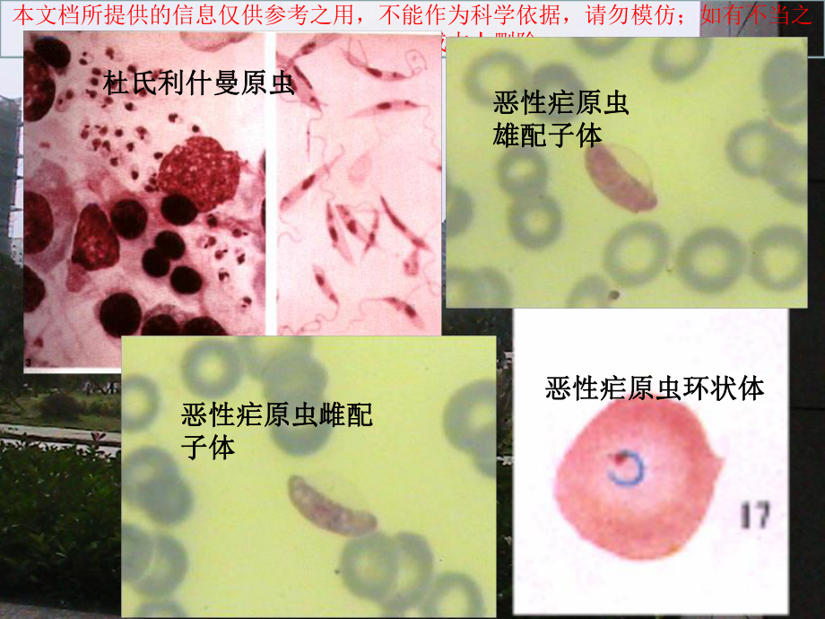 人体寄生虫实验考试图培训课件.ppt_第3页