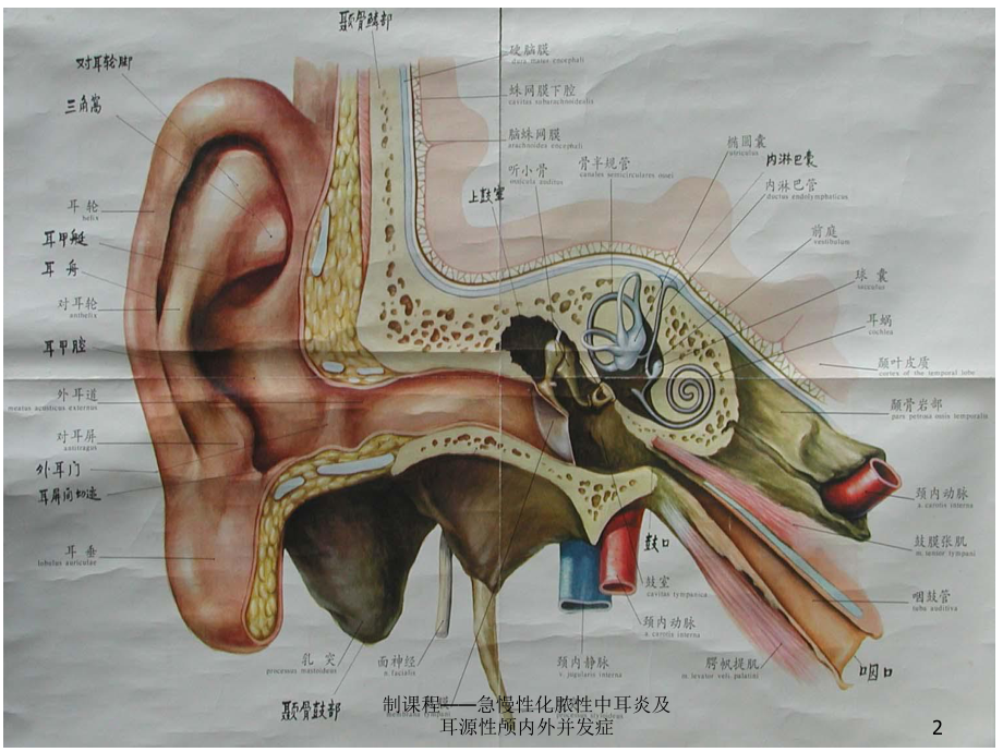 制课程-急慢性化脓性中耳炎及耳源性颅内外并发症课件.ppt_第2页