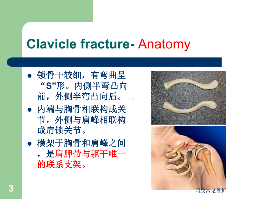 四肢常见骨折培训课件.ppt_第3页