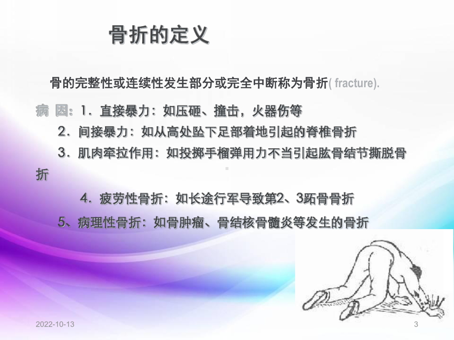 医学课件-骨折病人的护理课件.ppt_第3页