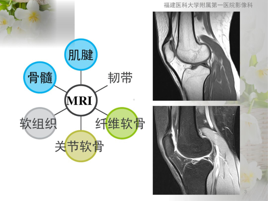 关节磁共振检查技术与诊断课件.pptx_第3页