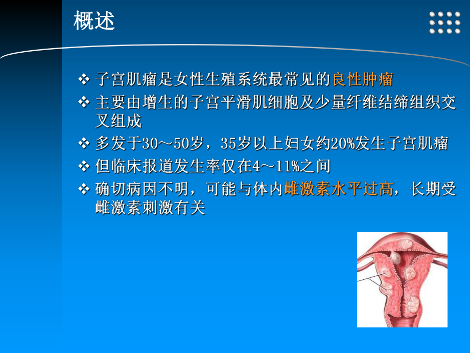 子宫肌瘤医学知识讲座课件.ppt_第2页