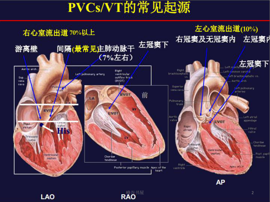 室早室速体表心电图定位诊断[研究材料]课件.ppt_第2页