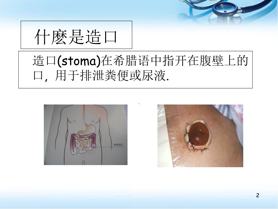 医学课件-造口护理课件.ppt_第2页