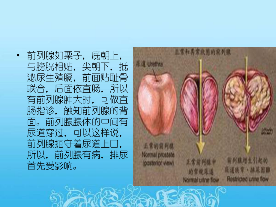 前列腺电切手术前后的注意事项主题讲座课件.ppt_第2页