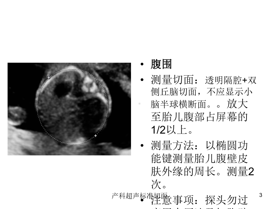 产科超声标准切面培训课件.ppt_第3页