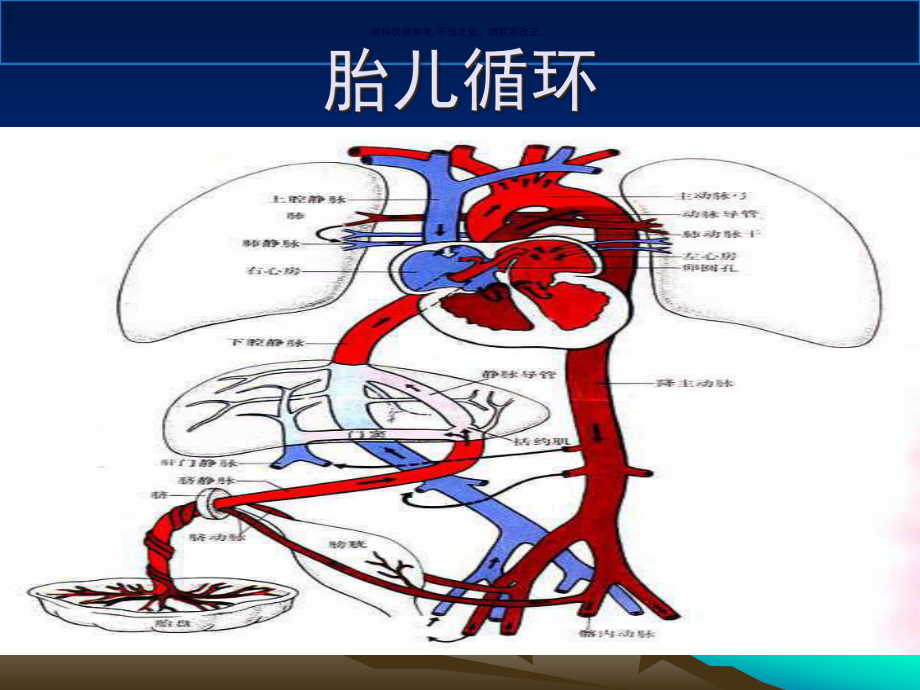 动脉导管未闭PDA课件.ppt_第3页