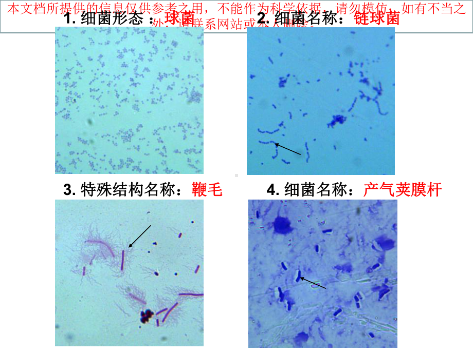 医疗微生物学切片考试切片完整版培训课件.ppt_第1页