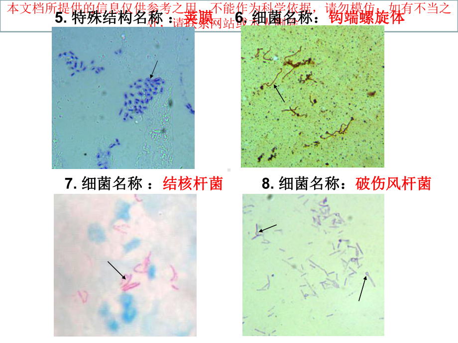 医疗微生物学切片考试切片完整版培训课件.ppt_第2页