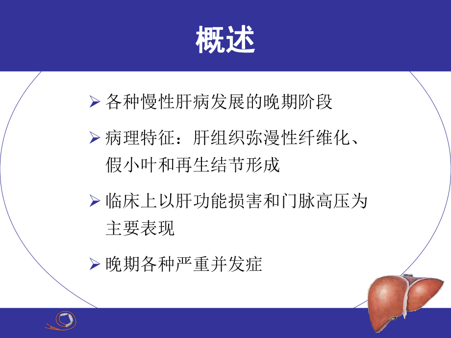 内科学肝硬化课件.ppt_第2页