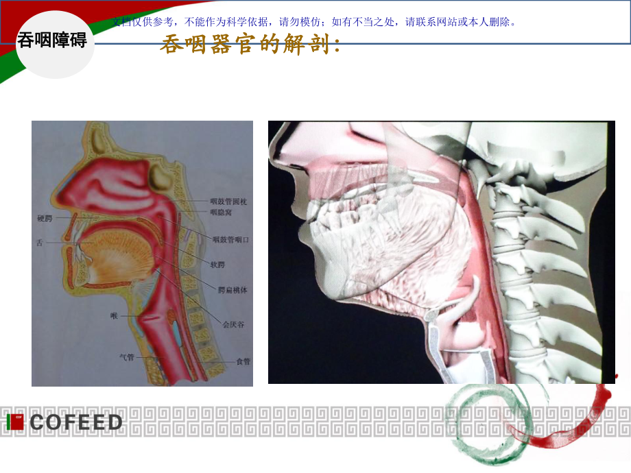 吞咽障碍专业医学知识宣讲课件.ppt_第3页