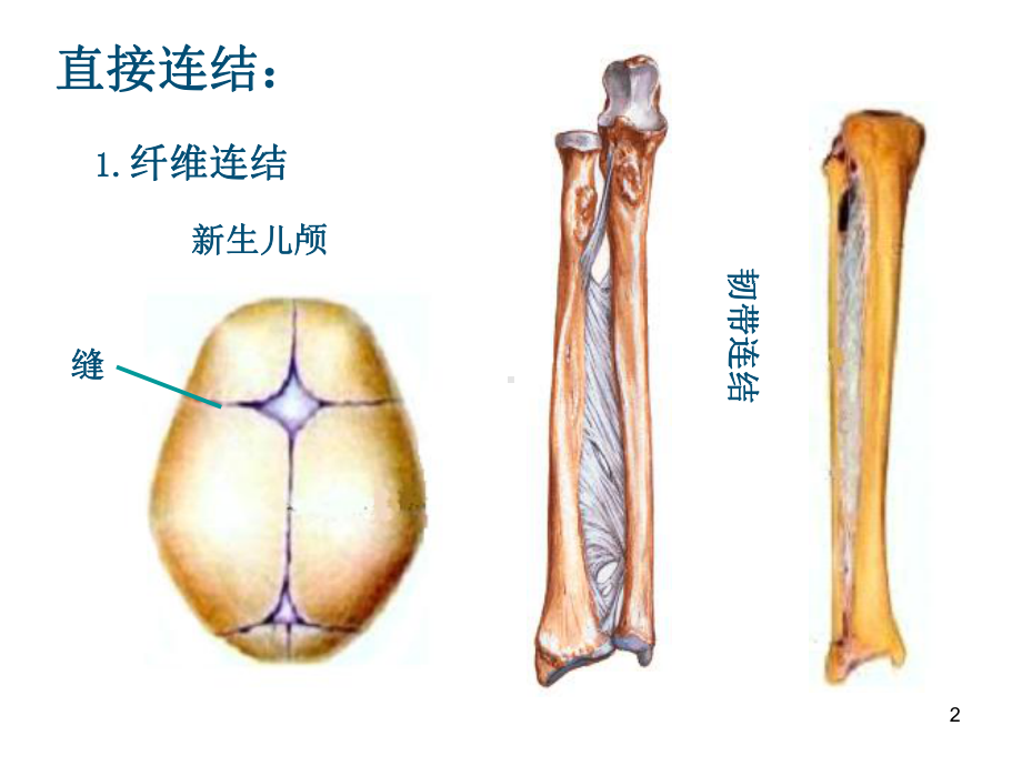 医学课件-骨连接教学课件.ppt_第2页