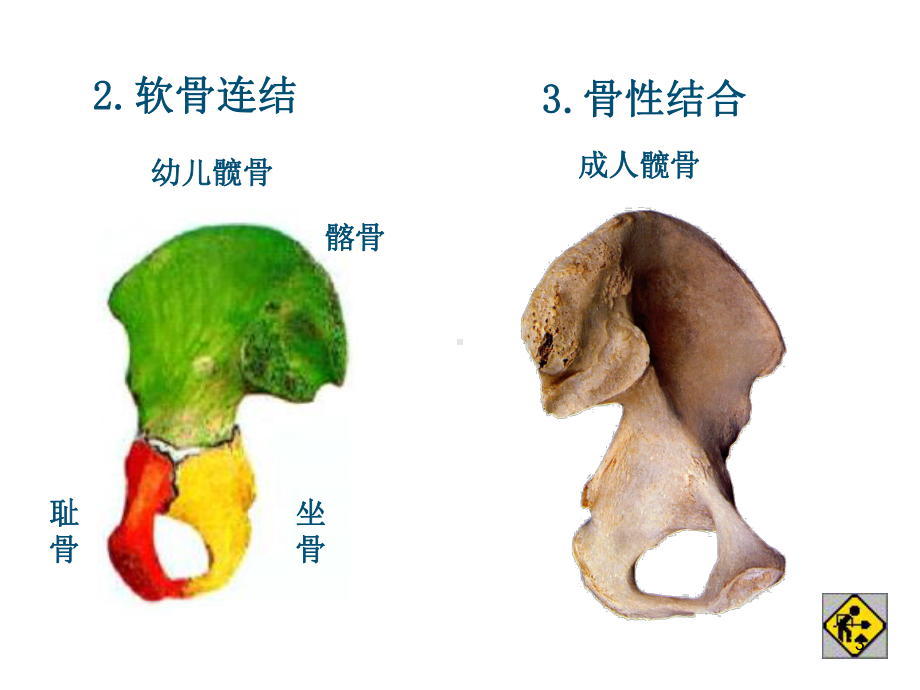 医学课件-骨连接教学课件.ppt_第3页