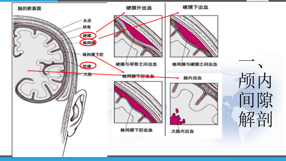 基层神经外科常见引流管介绍-课件.pptx_第2页