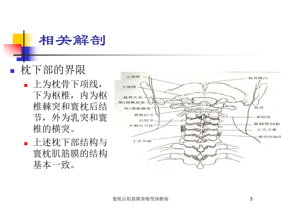 寰枕后肌筋膜挛缩型颈椎病培训课件.ppt_第3页