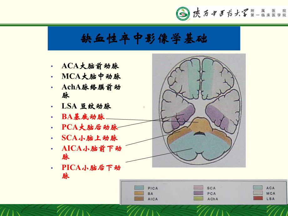 多模CT及磁共振的选择及判读-课件.ppt_第3页