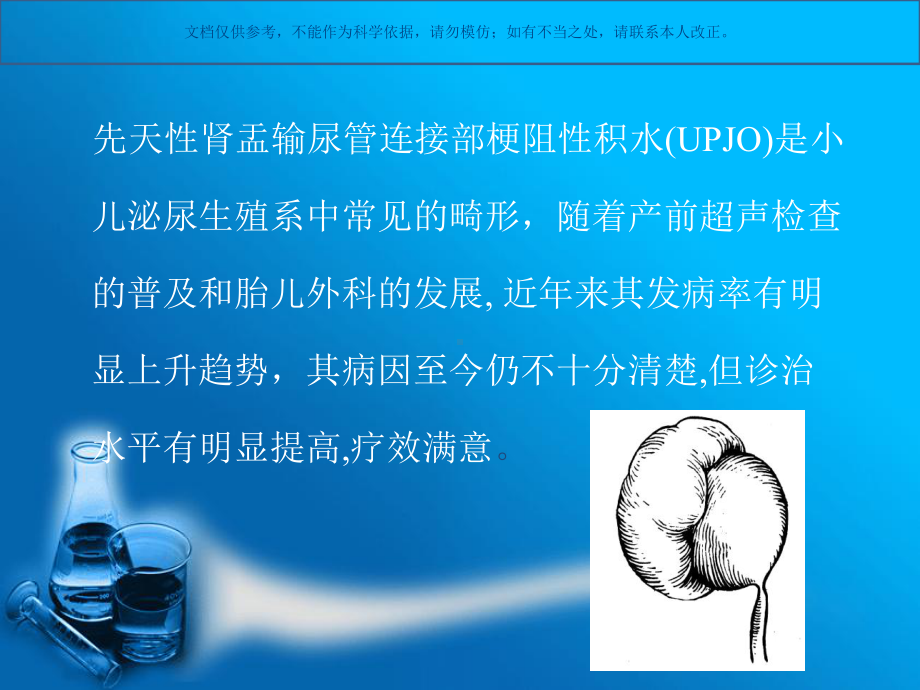 小儿肾积水进展科普课件.ppt_第2页