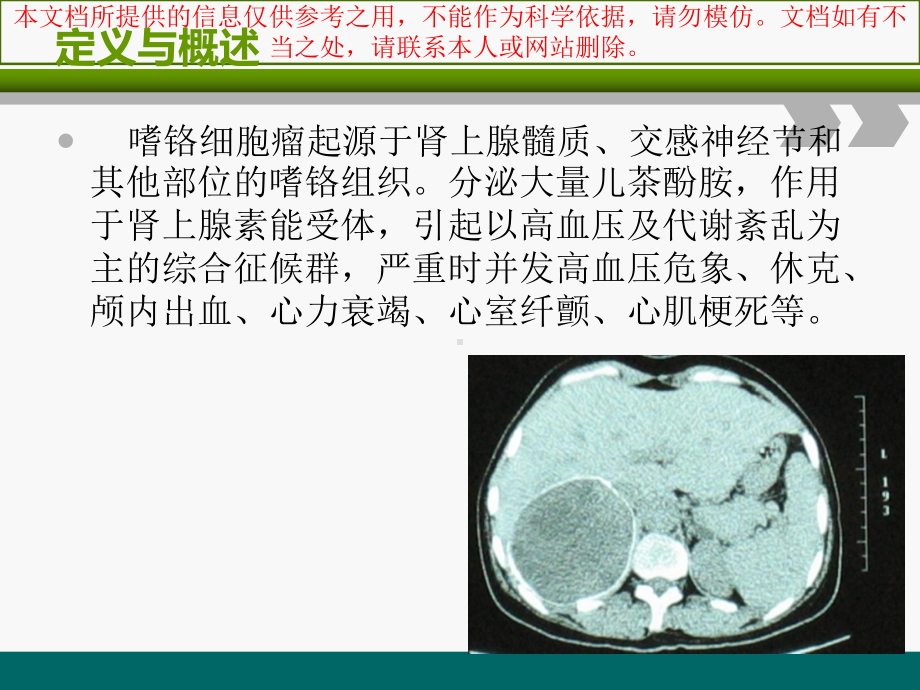 嗜铬细胞瘤的个案医疗护理查房培训课件.ppt_第3页